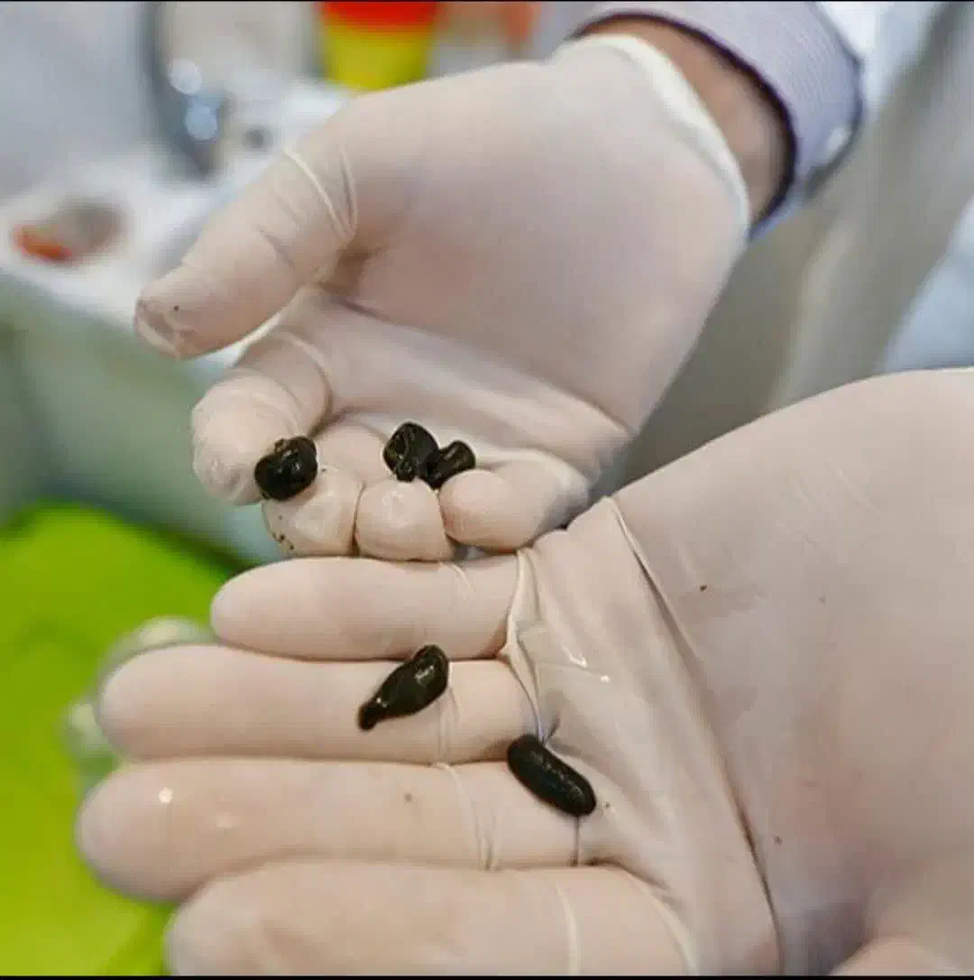 حجامت فصدزالو خال برداری.زگیل تناسلی انواع جراحی|خدمات آرایشگری و زیبایی|مشهد, وحید|دیوار