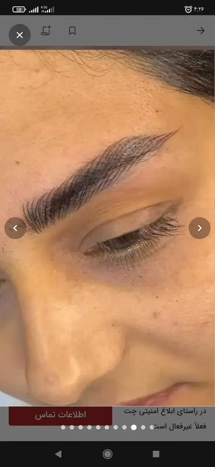 فشیال حرفه ای پوست|خدمات آرایشگری و زیبایی|تهران, مختاری|دیوار