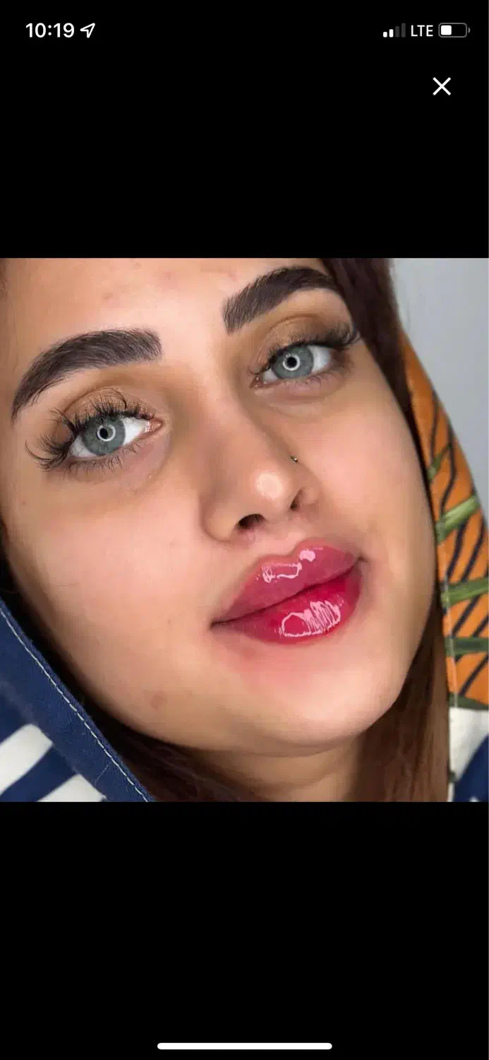 کلینیک پوست زیبایی تزریق ژل390مزوprp لیزر لاغری|خدمات آرایشگری و زیبایی|تهران, ستارخان|دیوار