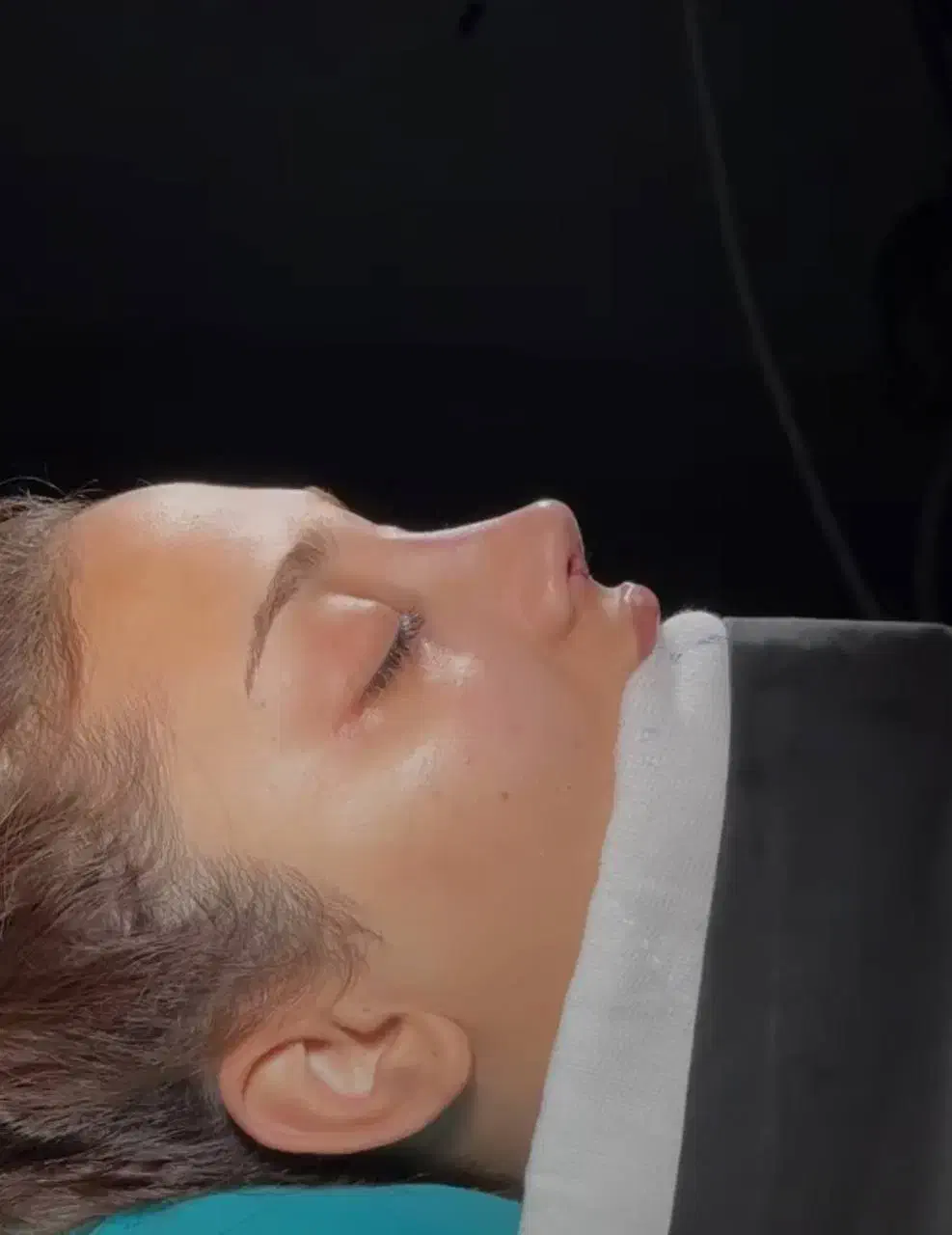 جراحی بینی عمل بینی بلفارو ساکشن غبغب لیفت صورت|خدمات آرایشگری و زیبایی|مشهد, احمدآباد|دیوار