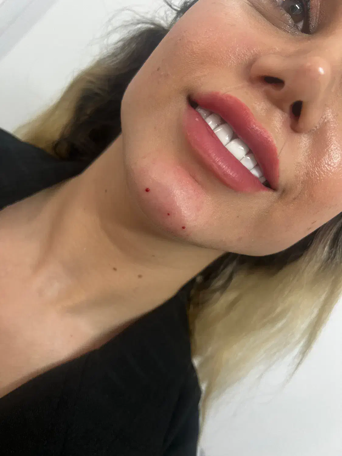 کلینیک زیبایی دکتر محمد باقر مهربانی ژل و بوتاکس|خدمات آرایشگری و زیبایی|ری, شهرری|دیوار