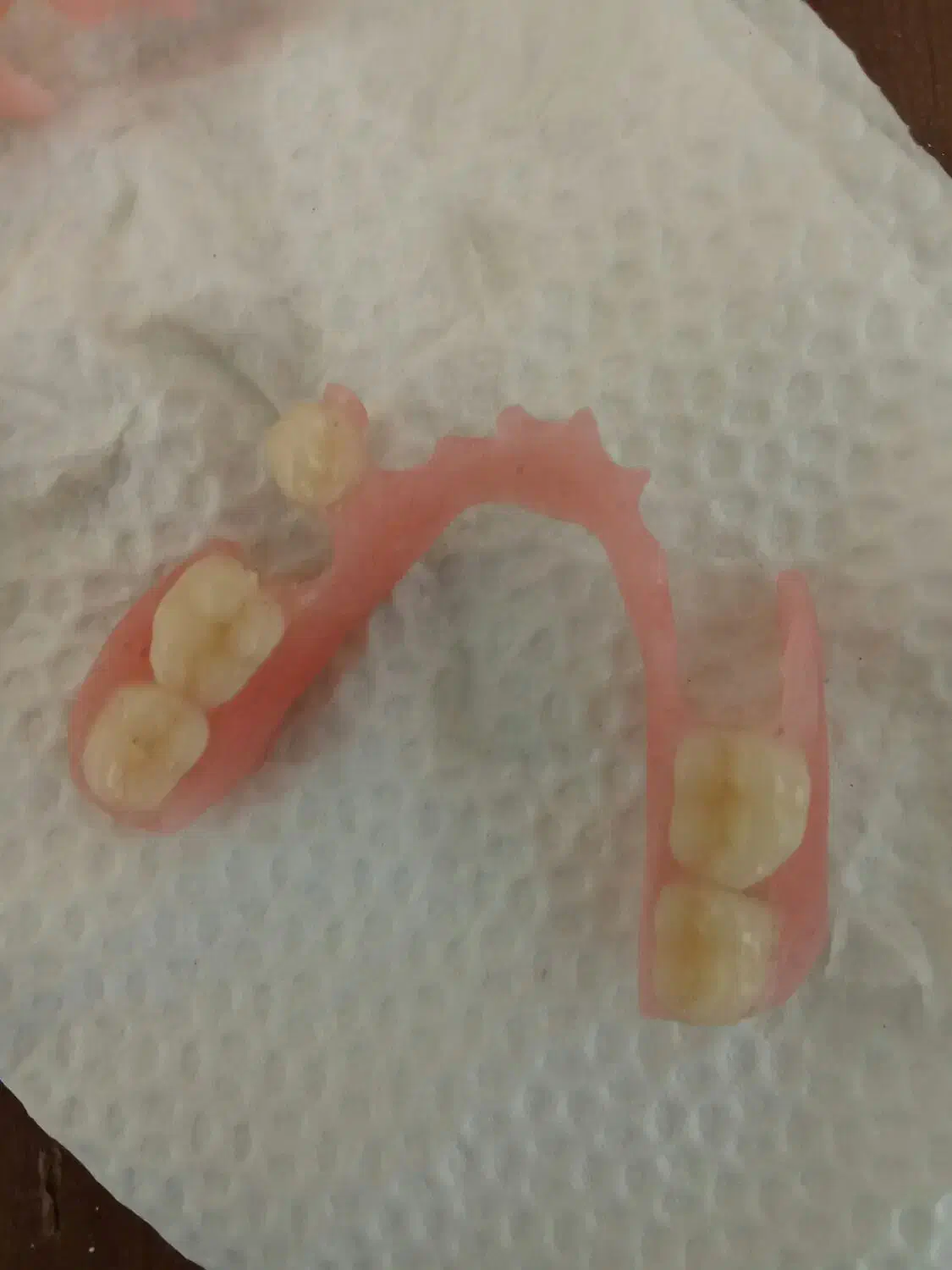 ساخت دندان مصنوعی در سنندج548276|خدمات آرایشگری و زیبایی|نورآباد, |دیوار