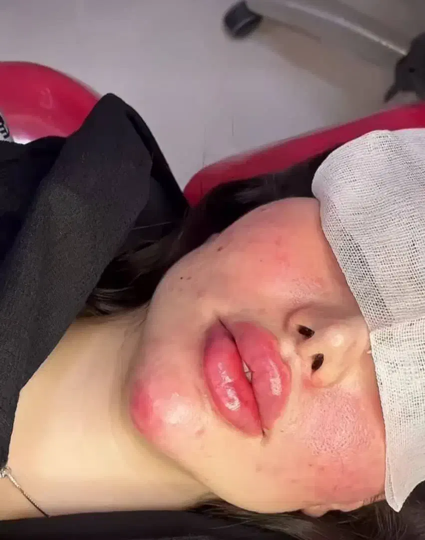 مطب پزشک.ژل وبوتاکس.لیفت بانخ.فیلربینی ژل آلت|خدمات آرایشگری و زیبایی|قم, دورشهر|دیوار