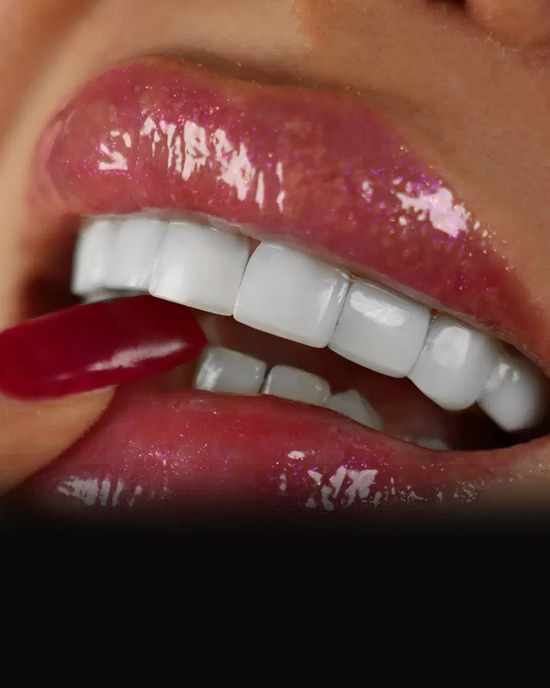 عصبکشی/کامپوزیت/کشیدن دندان|خدمات آرایشگری و زیبایی|ساری, |دیوار