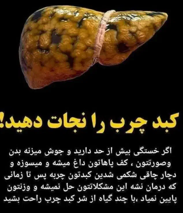 درمان و پاکسازی کبد|آرایشی، بهداشتی، درمانی|گنبد کاووس, |دیوار