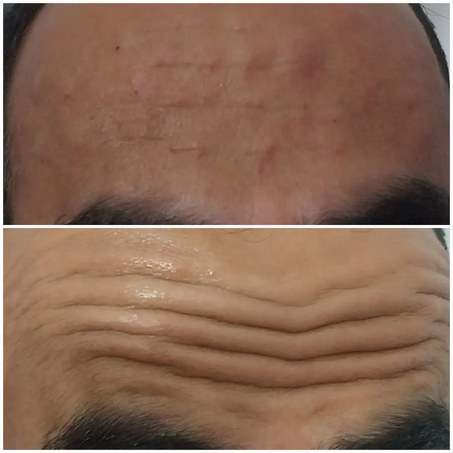 تخفیف ویژه‌ی خدمات ژل و بوتاکس بع مدت محدود|خدمات آرایشگری و زیبایی|ایذه, |دیوار