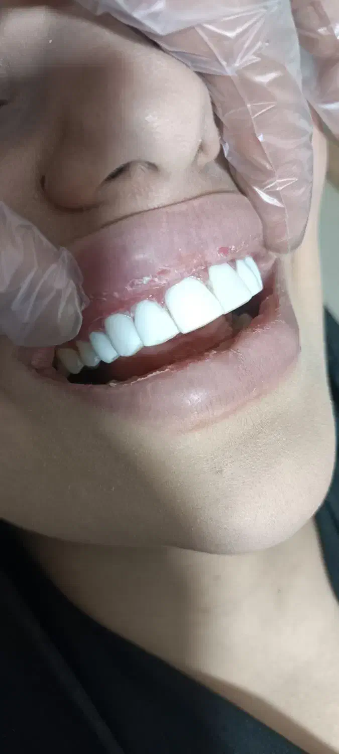 دندان سازی.دندان پزشکی|خدمات آرایشگری و زیبایی|خرم‌آباد, |دیوار