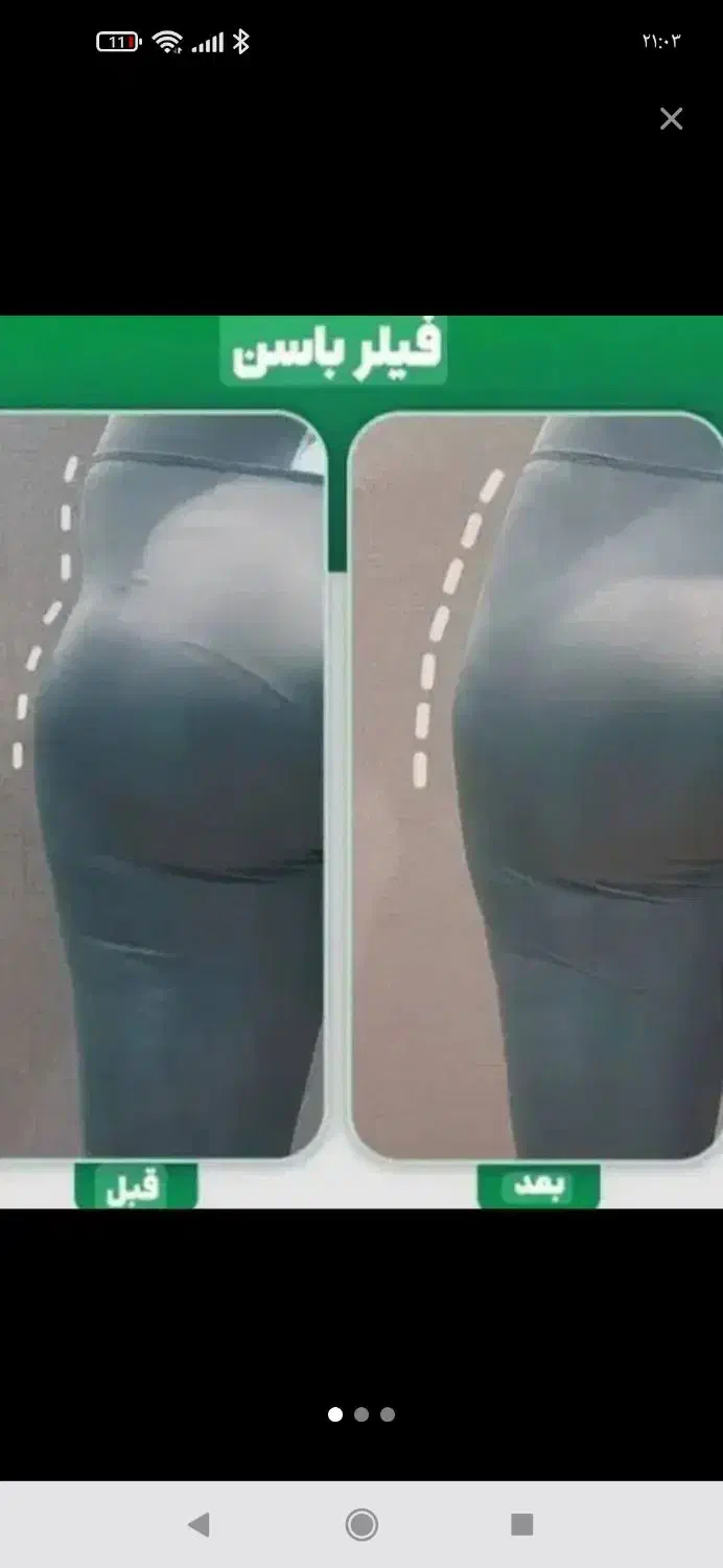 جشنواره تزریق تخصصی فیلر بادی بمناسبت شعبه جدید|خدمات آرایشگری و زیبایی|قم, بکایی|دیوار