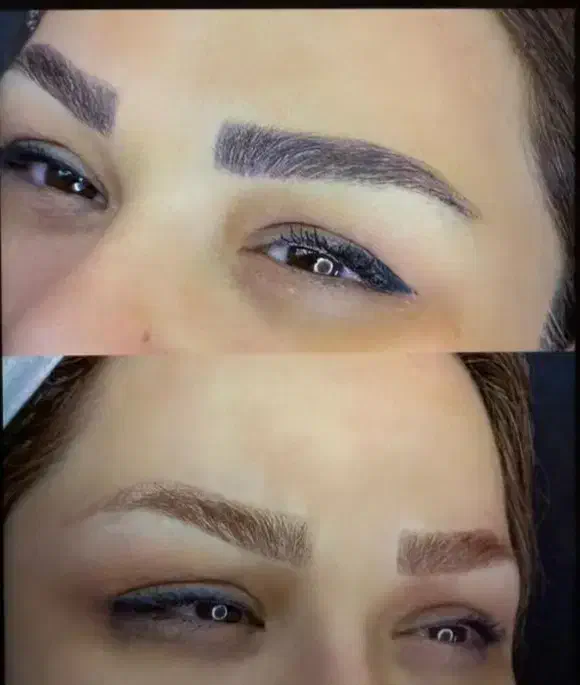 خداحافظی با تاتوهای زغالی و بدرنگ|خدمات آرایشگری و زیبایی|تهران, حکمت|دیوار