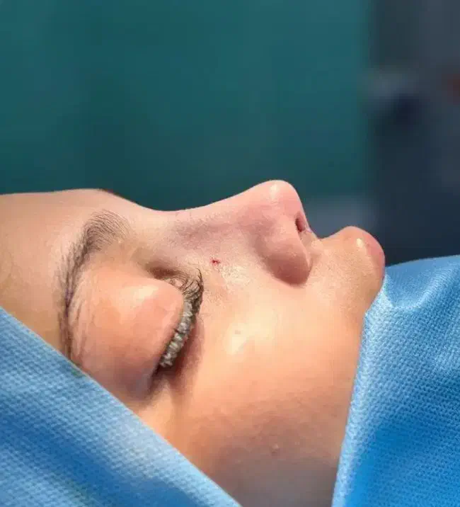 جراحی بینی ۲۴میلیون|خدمات آرایشگری و زیبایی|اسلامشهر, شهرک قائمیه|دیوار