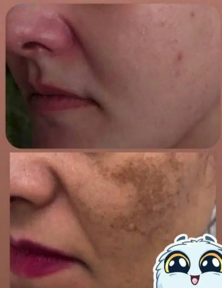 کرم وی ای پی اصل صدرصد تضمینی و بدون بازگشت|آرایشی، بهداشتی، درمانی|یاسوج, |دیوار