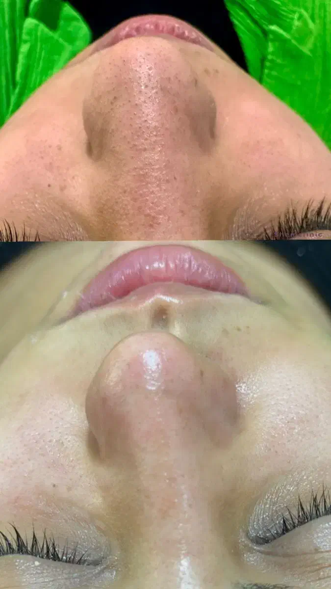 انجام خدمات پاکسازی و فیشیال تخصصی|خدمات آرایشگری و زیبایی|زرند, |دیوار