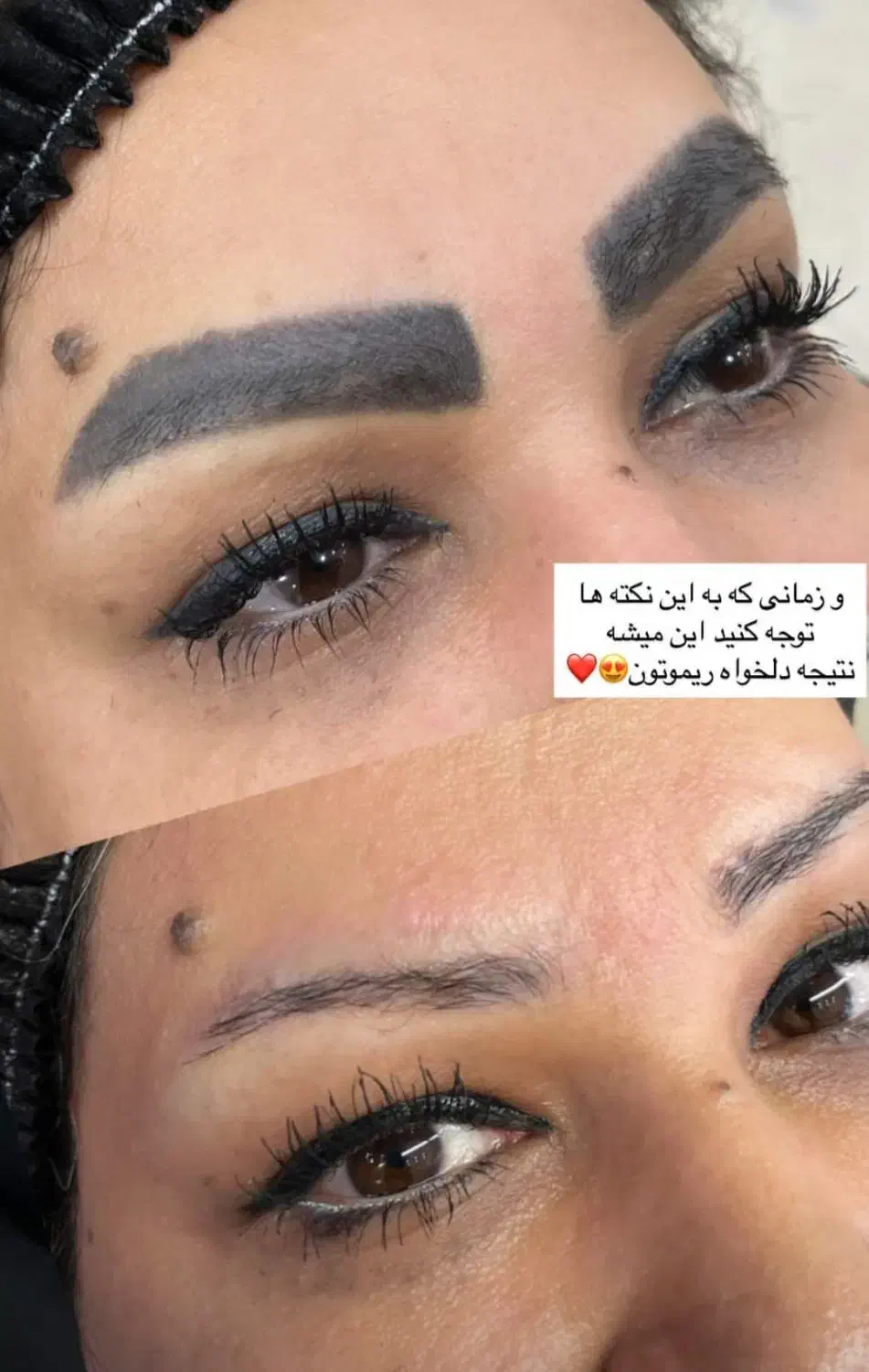 ریموور تخصصی  تاتو با مواد اصل آمریکایی با ضمانت|خدمات آرایشگری و زیبایی|جیرفت, |دیوار