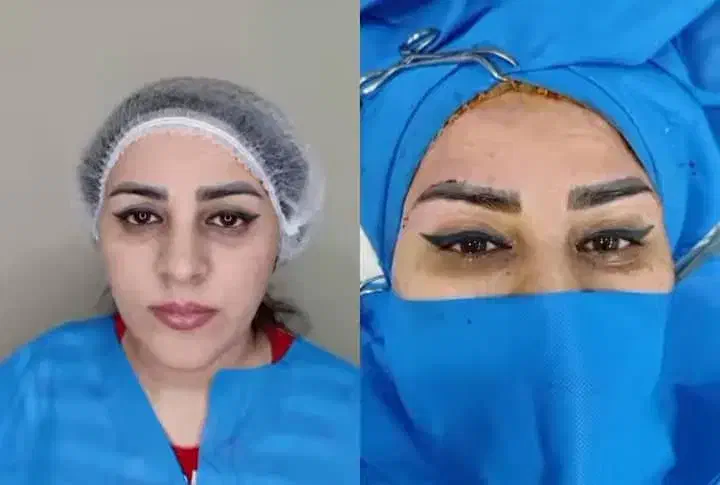 زیبایی وجوانسازی|خدمات آرایشگری و زیبایی|تهران, بوستان چیتگر|دیوار