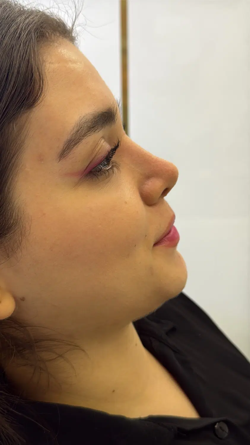 جراحی بینی کلینیک دکتر احسانی|خدمات زیبایی و سلامت|تهران, مرزداران|دیوار
