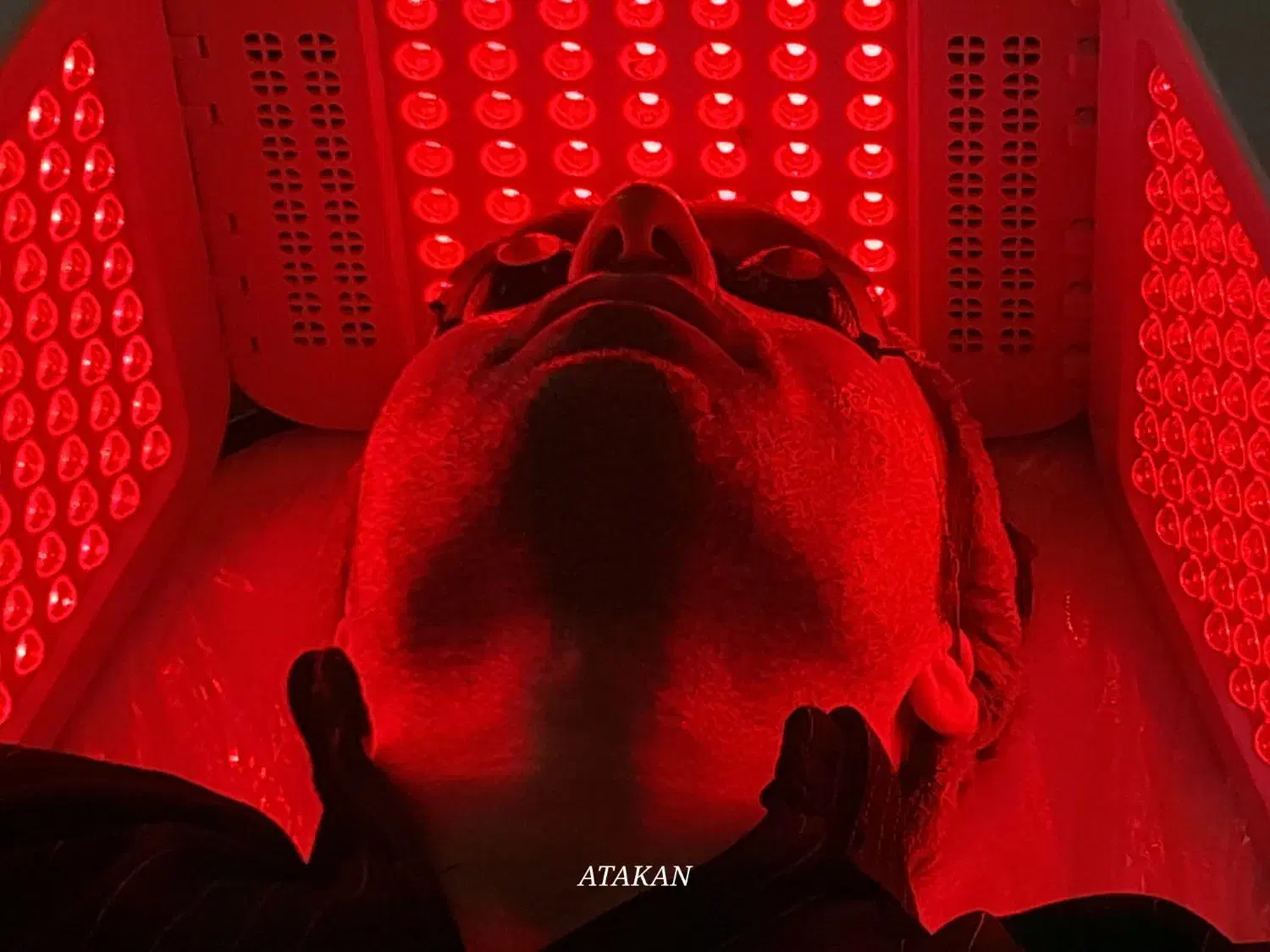 آموزش فیشال و پاکسازی پوست ویژه سال جدید|خدمات آموزشی|خوی, |دیوار