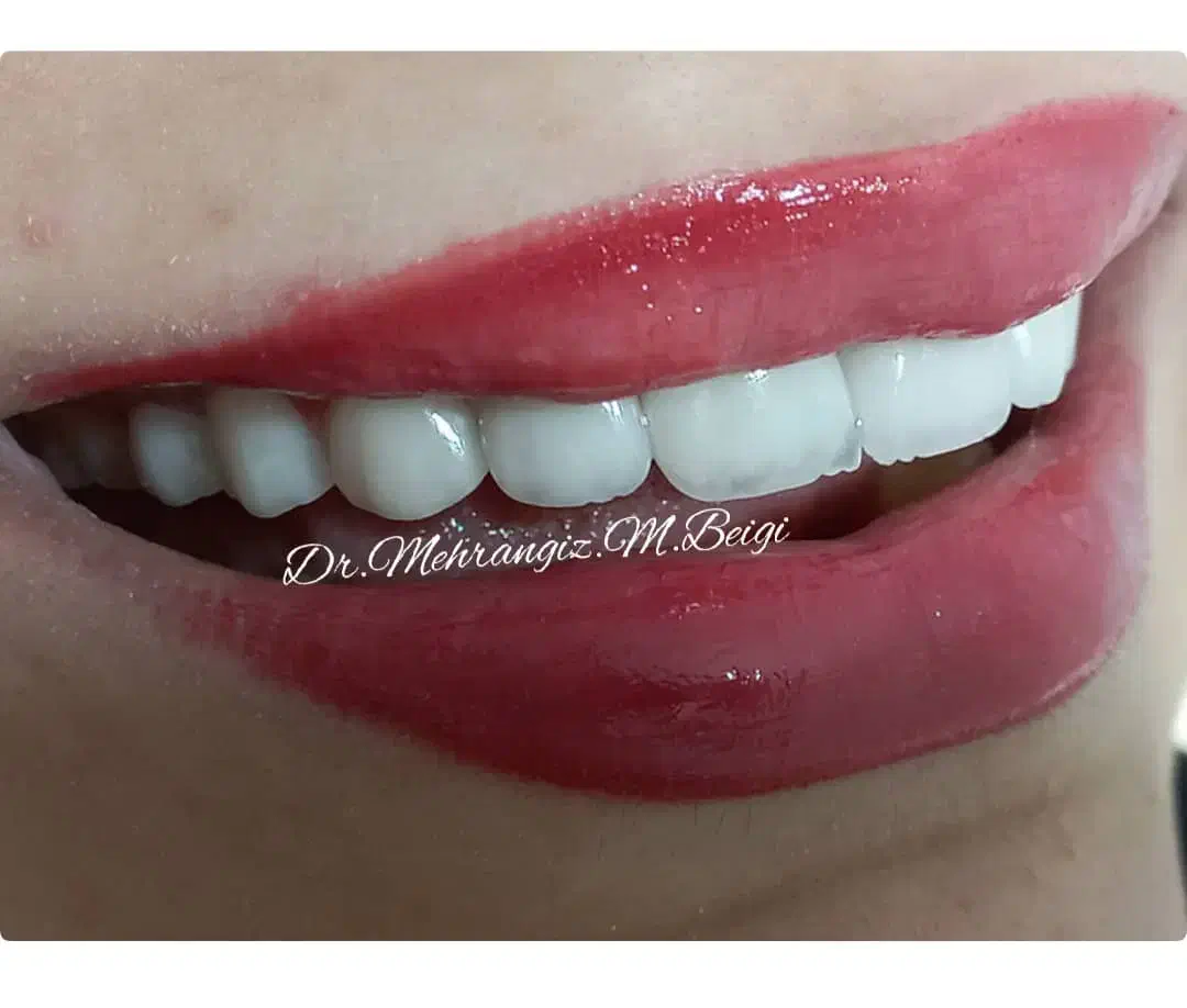 دندانپزشکی زیبایی و لمینت|خدمات آرایشگری و زیبایی|تهران, سلیمانی|دیوار