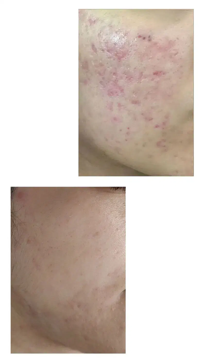 آموزش فیشال صفر تا ۱۰۰|خدمات آموزشی|تبریز, |دیوار