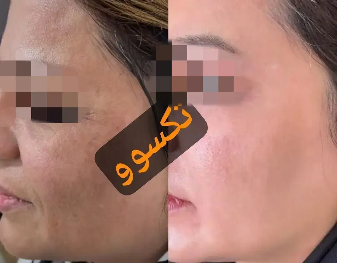 مثل کره چربی بسوزون و به اندام ایده آلت برس|آرایشی، بهداشتی، درمانی|جیرفت, |دیوار