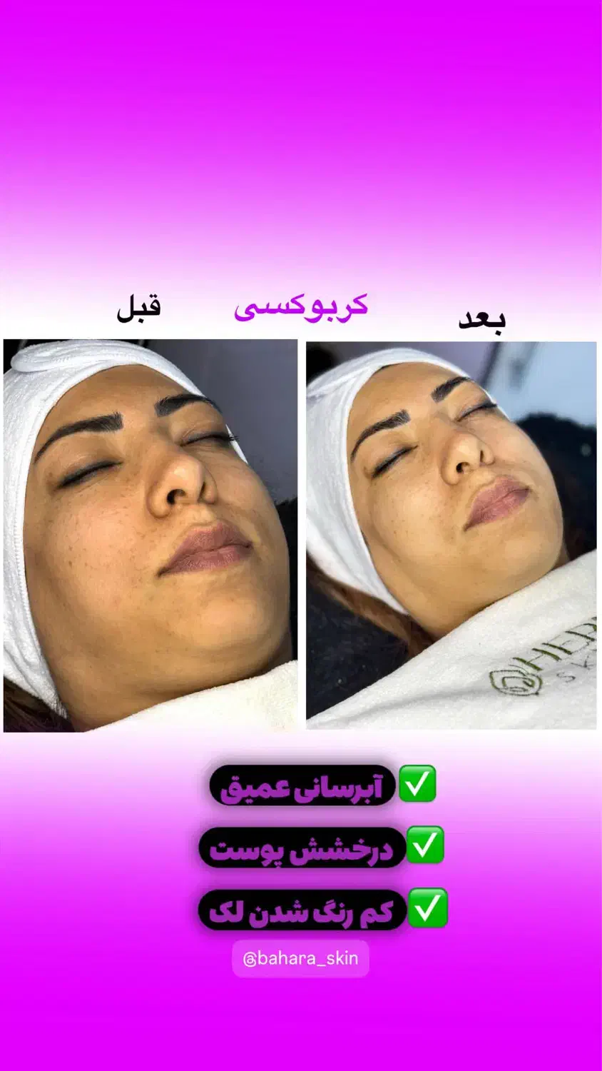 تخفیف پاییزه فیشال کلاسیک|خدمات آرایشگری و زیبایی|دوگنبدان, |دیوار