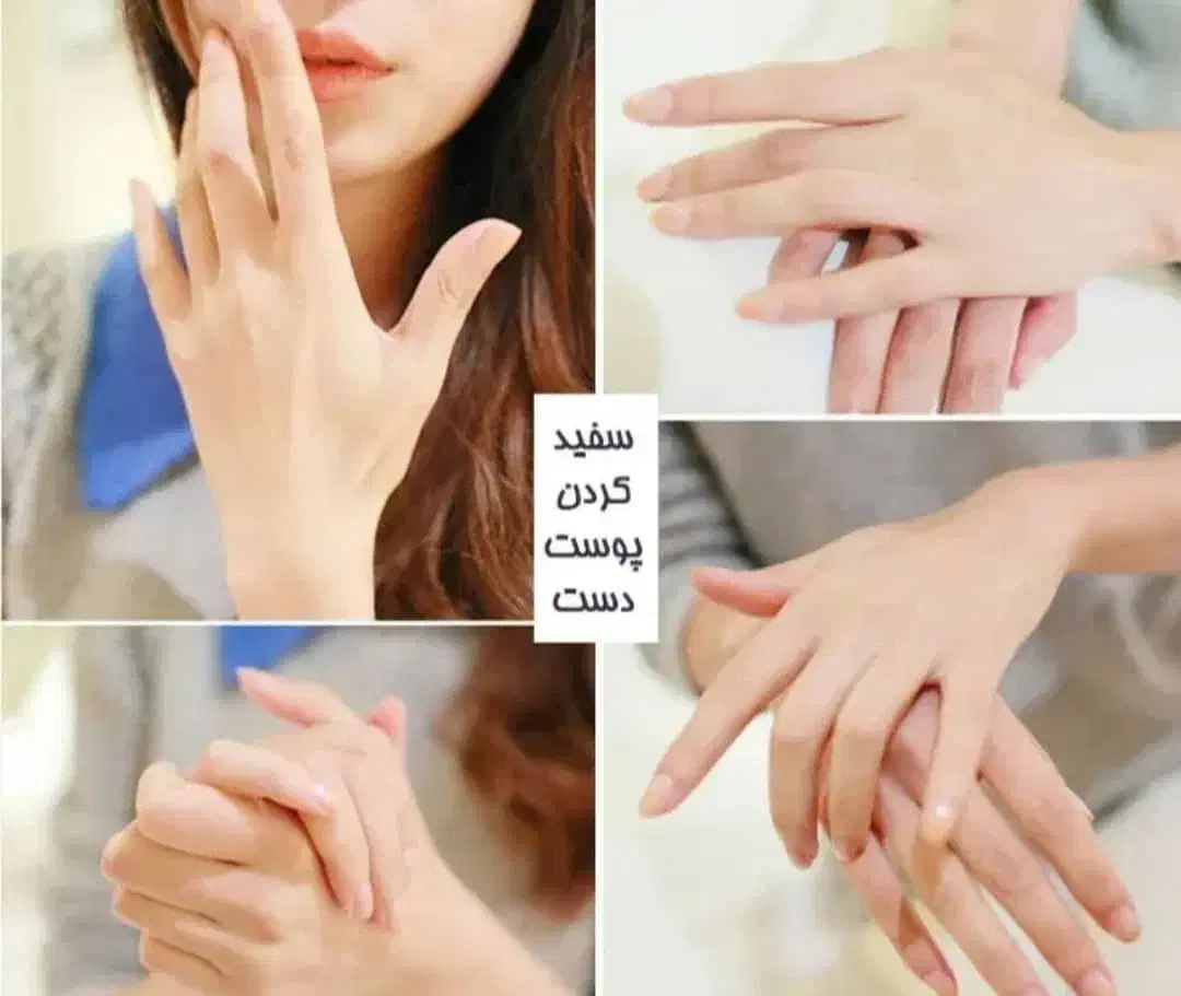 فرمول کرم سفید کننده پوست|آرایشی، بهداشتی، درمانی|شیراز, گلکوب|دیوار