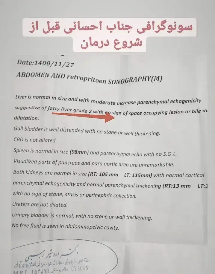 اگه درگیر کبد چرب هستی پیام بده|آرایشی، بهداشتی، درمانی|امامزاده عبدالله, |دیوار