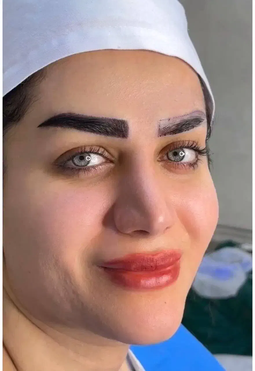 ۲۰٪ تخفیف تکرار نشدی بلفاروپلاستی اندولیفت کاشت|خدمات آرایشگری و زیبایی|فردیس, فردیس|دیوار