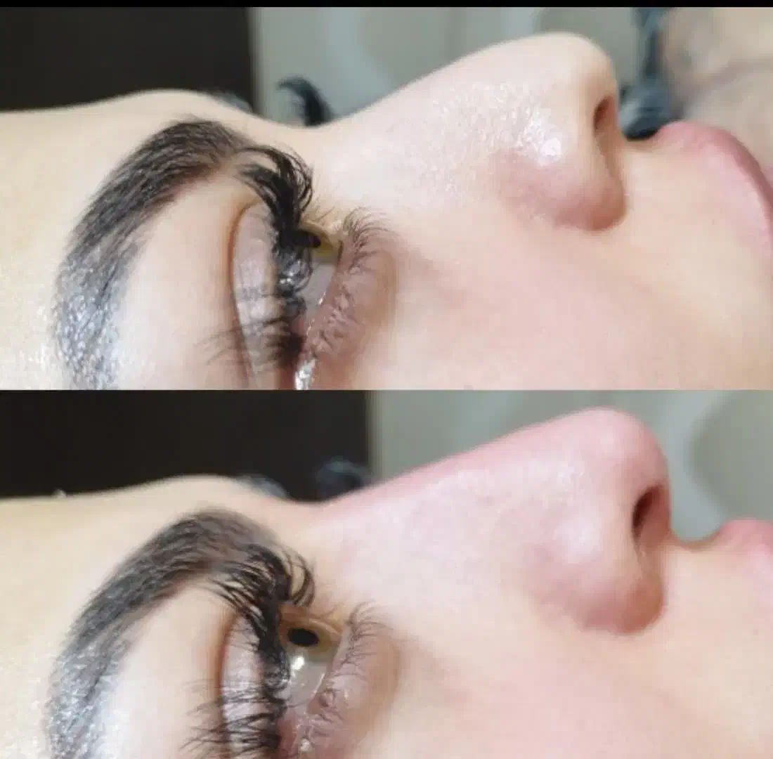 خدمات ژل بیکینی و زیر چشم و بوتاکس|خدمات آرایشگری و زیبایی|شاهین‌شهر, فردوسی|دیوار