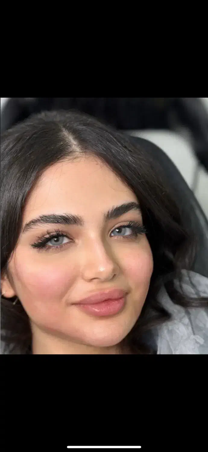 اف یلدایی ژل و بوتاکس|خدمات آرایشگری و زیبایی|اهواز, کوی ملی راه|دیوار