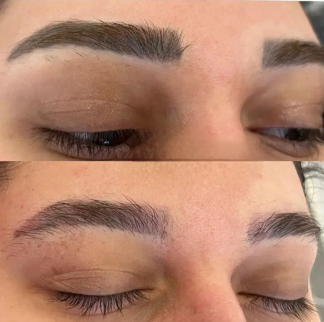 ریموور تتوهای قدیمی و تیره|خدمات آرایشگری و زیبایی|بندر کنگان, |دیوار