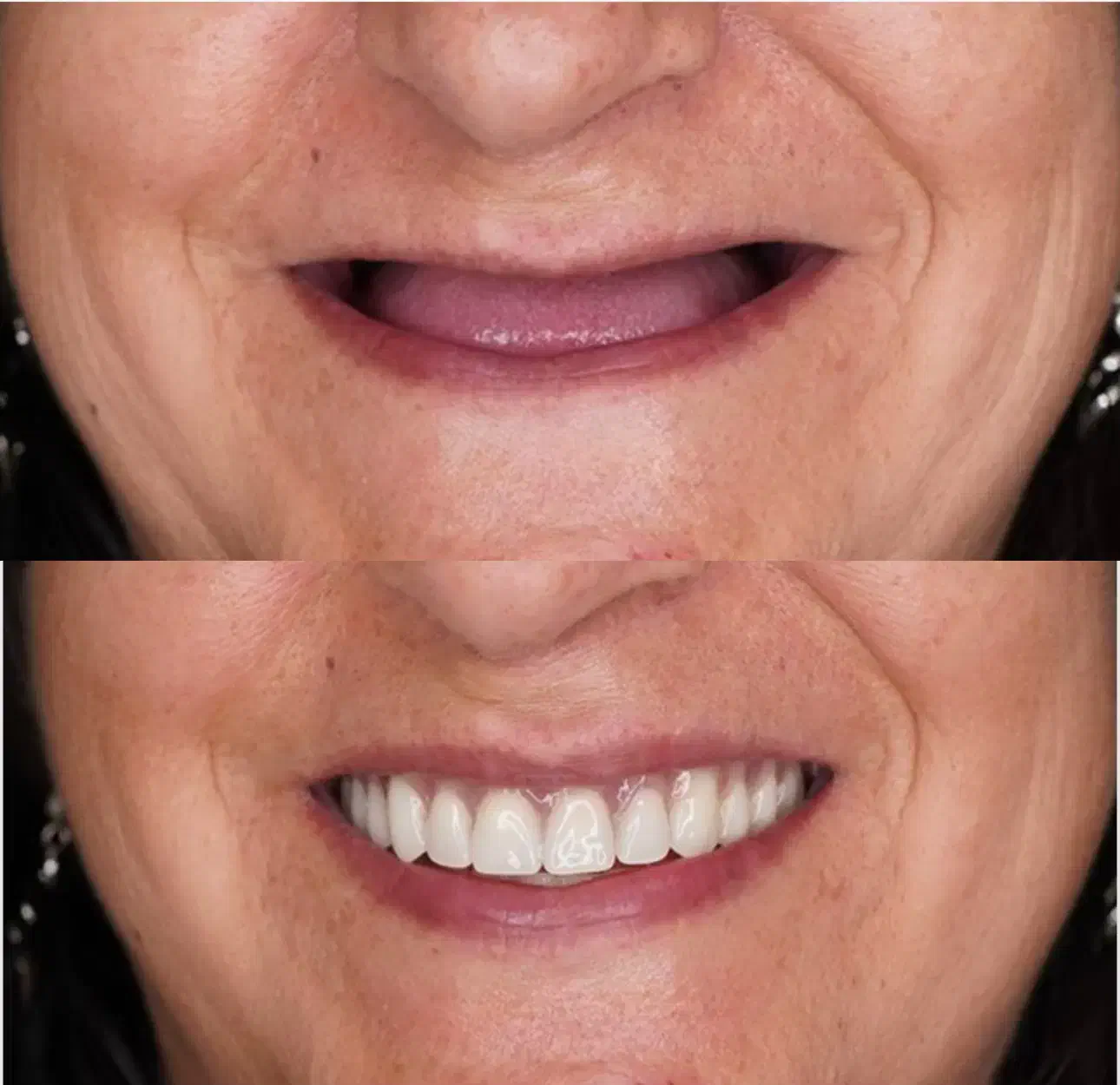 وام دندانپزشکی ایمپلنت|خدمات آرایشگری و زیبایی|رباط‌کریم, رباط‌کریم|دیوار