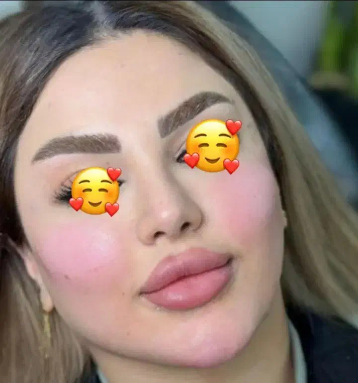 ژل و بوتاکس|خدمات آرایشگری و زیبایی|کارون, |دیوار