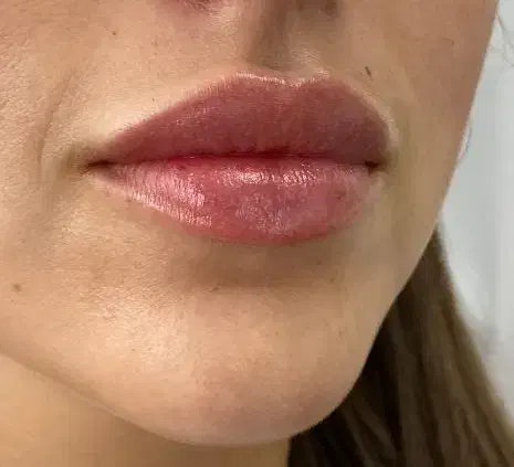 خدمات زیبایی ژل و بوتاکس|خدمات آرایشگری و زیبایی|اردبیل, |دیوار