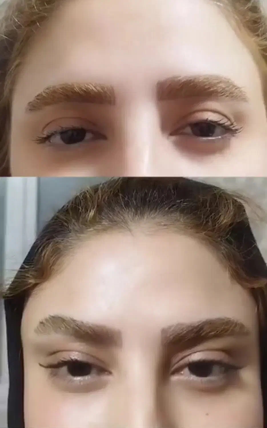 لیپوساکشن|خدمات آرایشگری و زیبایی|بروجرد, |دیوار