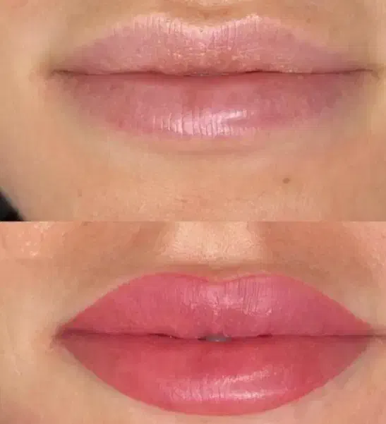 آموزش صفرتا صد فیبروز|خدمات آموزشی|سهند, |دیوار