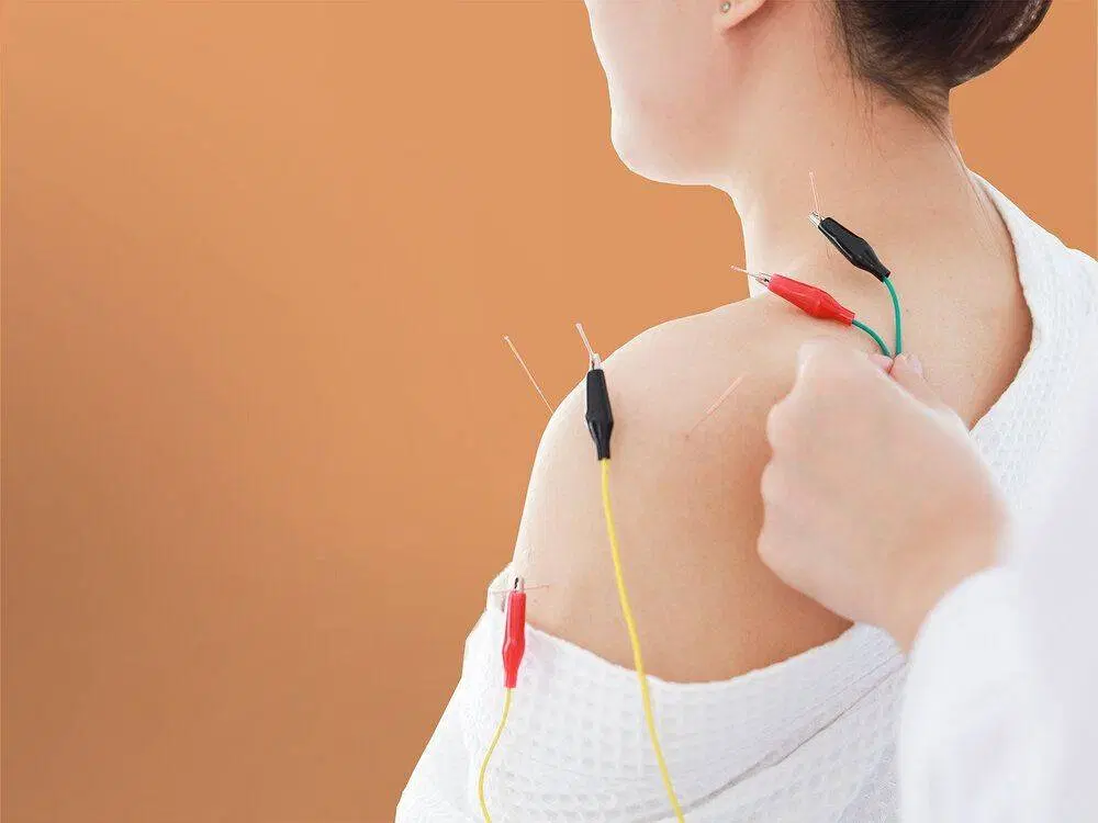 طب سوزنی تخصصی(اکوپانچریست)،امبدینگ لاغری|خدمات زیبایی و سلامت|تهران, دبستان|دیوار