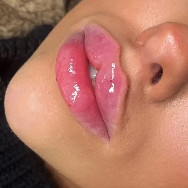 جشنواره ژل و بوتاکس و فیلر بادی و لیفت صورت|خدمات آرایشگری و زیبایی|تهران, صادقیه|دیوار