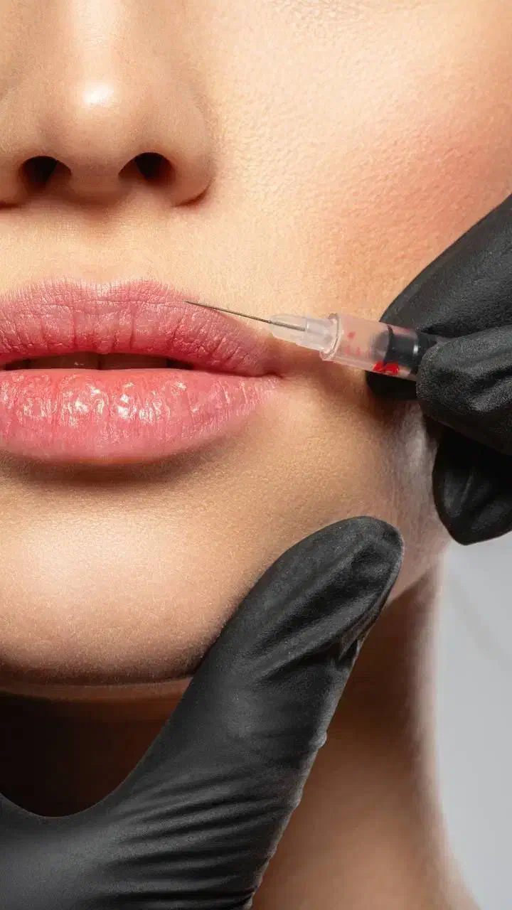مدل تزریق کلینیک زیبایی|خدمات آرایشگری و زیبایی|ساری, |دیوار