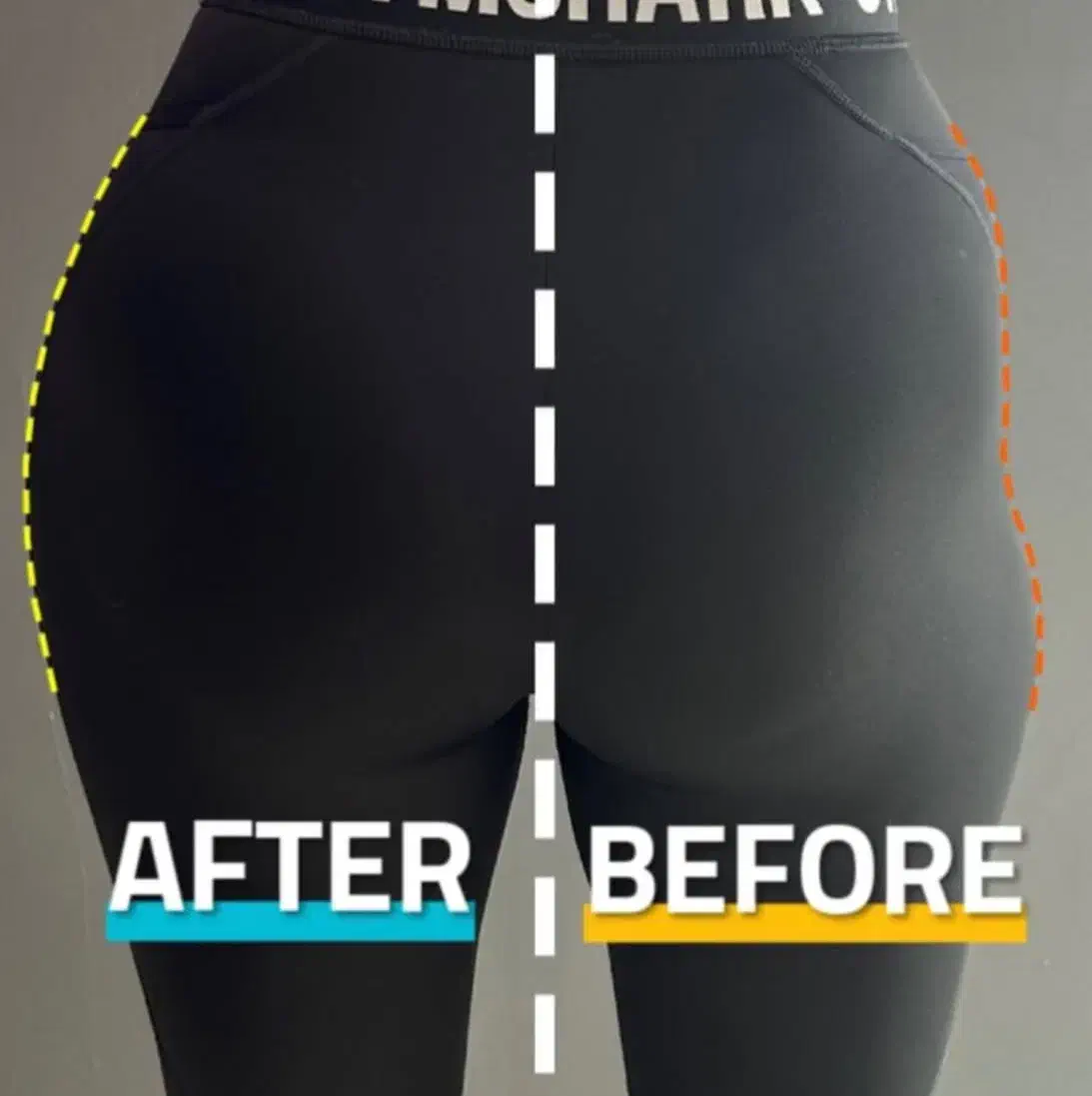 ساکشن چربی ترانسفر به هیپ دیپ و باسن فیلربادی غبغب|خدمات آرایشگری و زیبایی|تهران, شهرک صدرا|دیوار