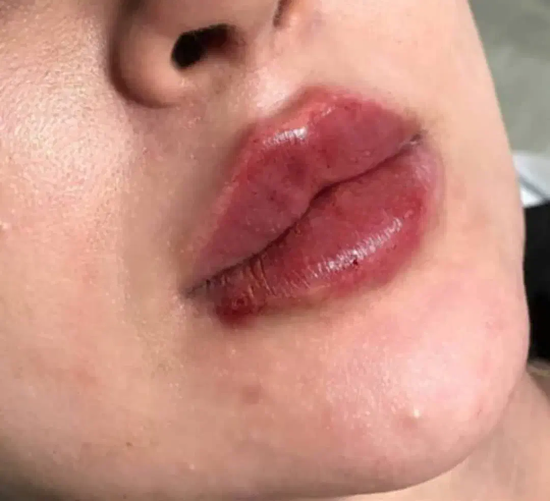 تزریق ژل و بوتاکس و کاشت نخ و مزوژل های جوان ساز|خدمات آرایشگری و زیبایی|شیراز, ابیوردی|دیوار