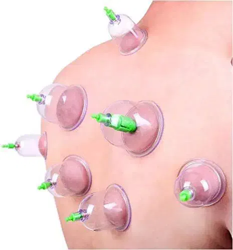 دستگاه بادکش|آرایشی، بهداشتی، درمانی|مرند, |دیوار