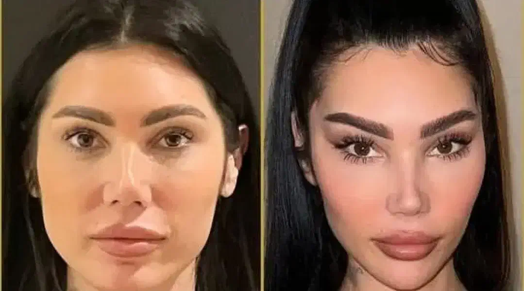 پزشک جراحی بلفا غبغب نخ لیفت کلاژن آنزیم ژل فیلر|خدمات آرایشگری و زیبایی|کرج, گوهردشت|دیوار