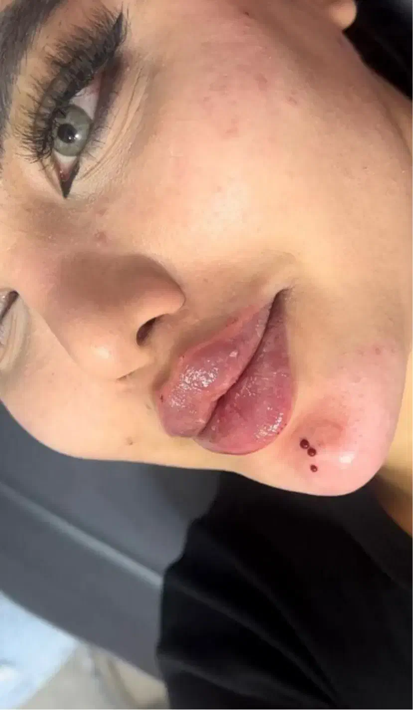 ژل و بوتاکس فقط ۳۹۰|خدمات آرایشگری و زیبایی|قم, زنبیل آباد|دیوار