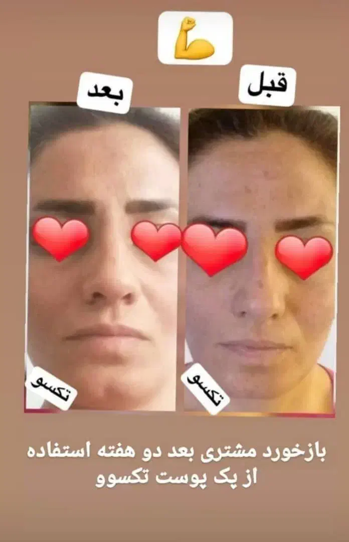 پوستی صاف وشفاف|آرایشی، بهداشتی، درمانی|قم, صفائیه|دیوار