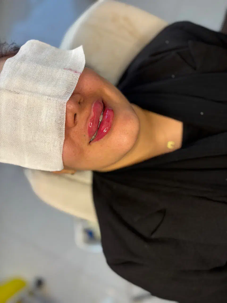 تزریق ژل و بوتاکس اف تا فردافقط۹۸۰|خدمات آرایشگری و زیبایی|یاسوج, |دیوار