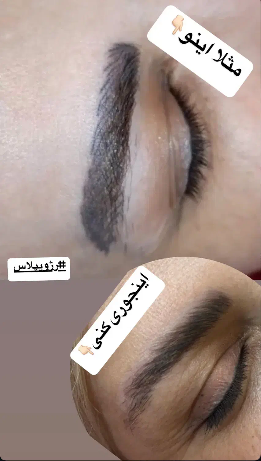 مدل رایگان ریموو تاتو قدیمی|خدمات آرایشگری و زیبایی|قشم, |دیوار