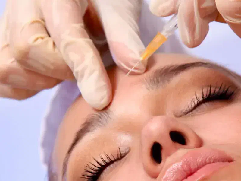 تخفیف ویژه تزریق بوتاکس به مدت محدود توسط پزشک|خدمات آرایشگری و زیبایی|لاهیجان, طالقانی|دیوار