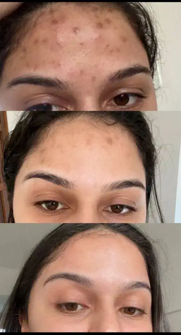 پاکسازی کبد فقط در ۴۰ روز|خدمات آرایشگری و زیبایی|گنبد کاووس, |دیوار