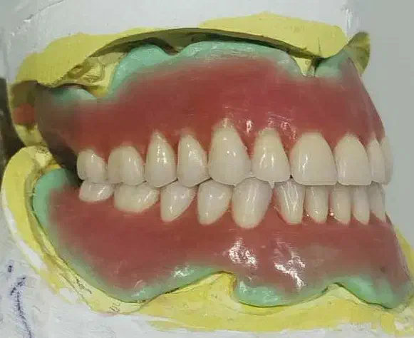 دندانپزشکی زیبایی تخفیف شب یلدااقساط|خدمات آرایشگری و زیبایی|پارس‌آباد, |دیوار