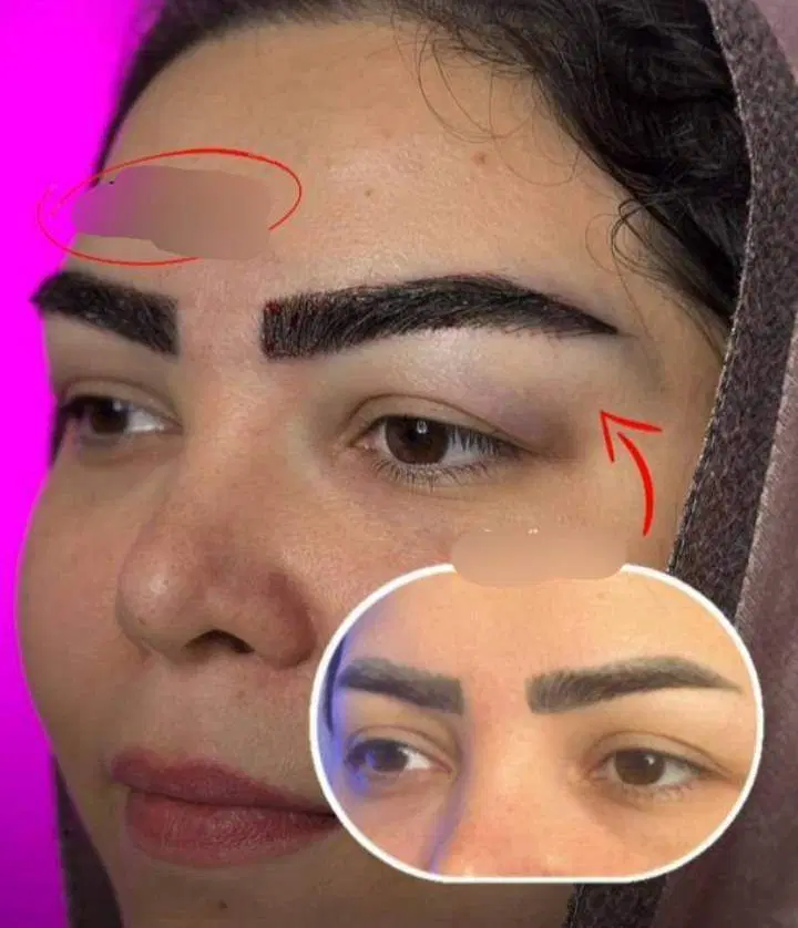 متخصص کاشت ابروتهران/قرینه/اقساطی|خدمات زیبایی و سلامت|تهران, صادقیه|دیوار
